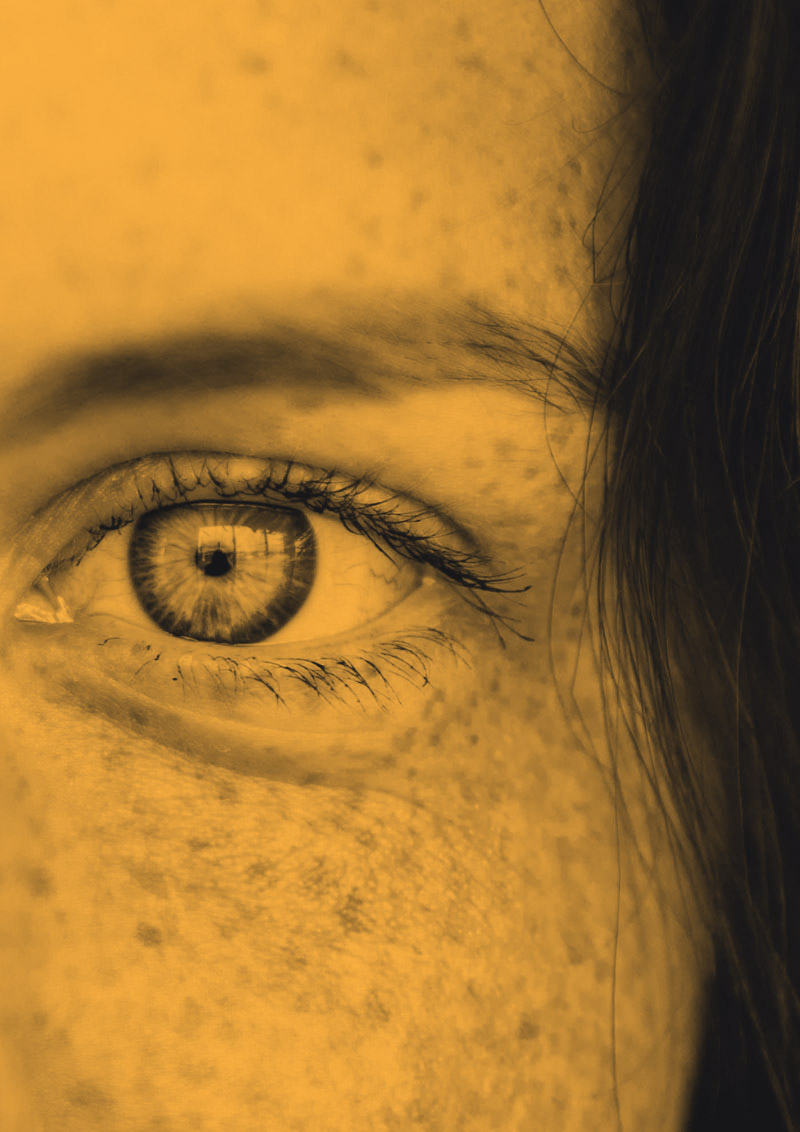 photo-y2 skin cancer 1
