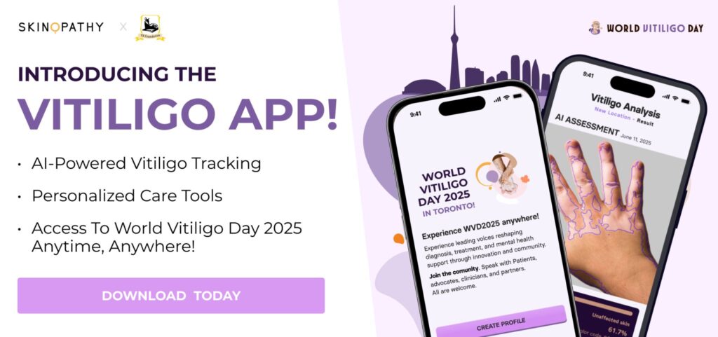 Skinopathy Vitiligo App